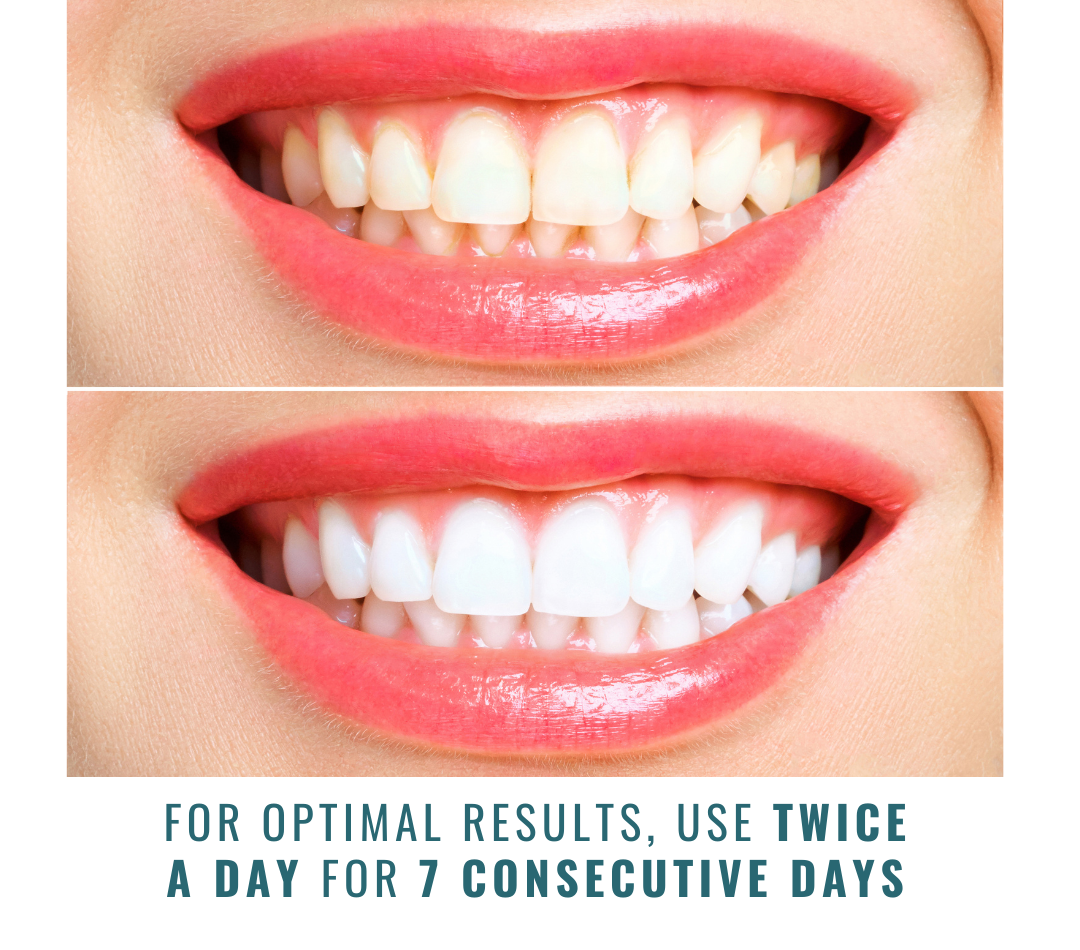 iLUMI 7 Day Express Vegan Whitening Strips, 14 Treatments