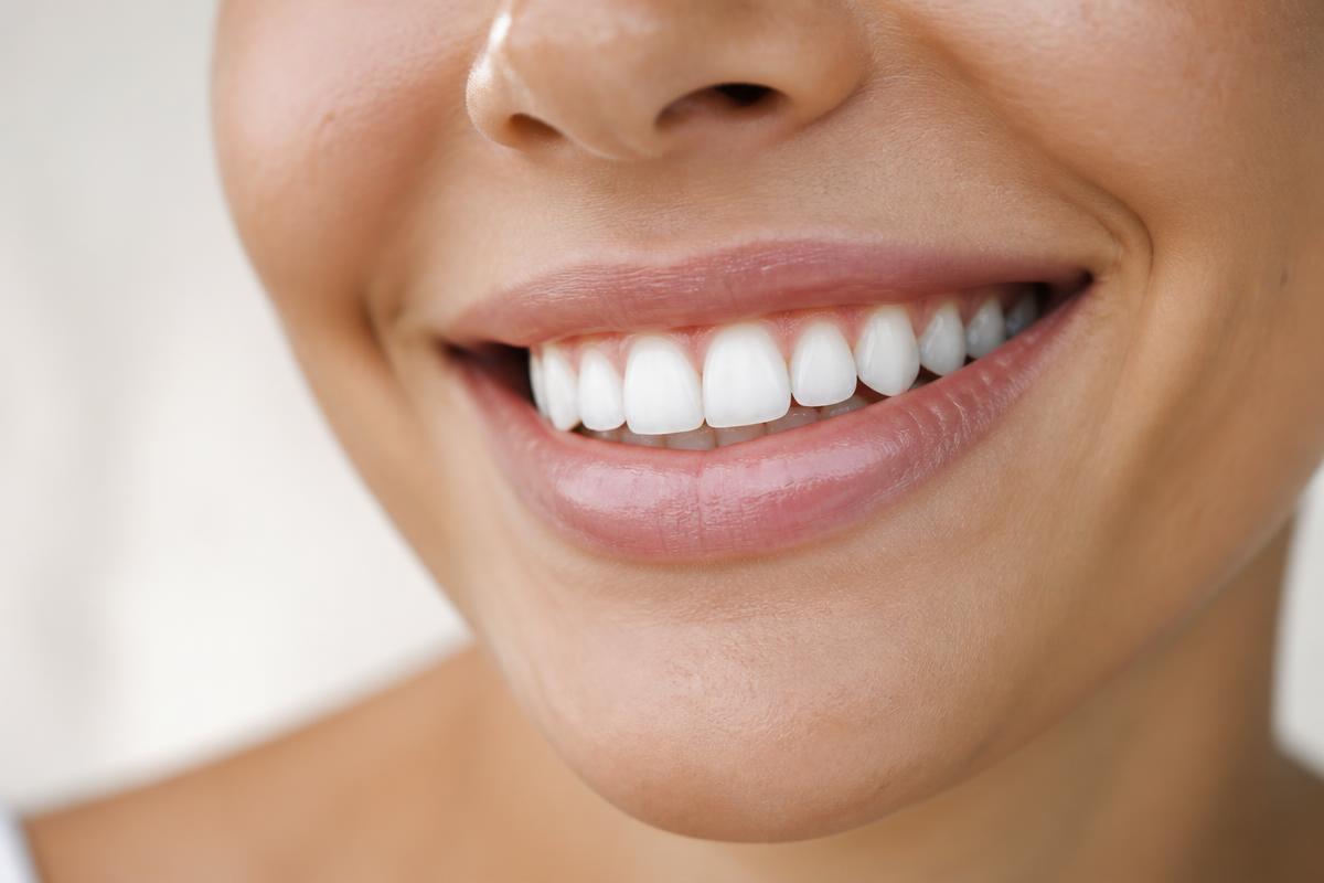 Close-up of a bright, natural-looking white smile